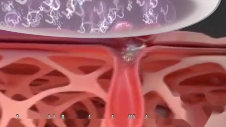 Плазменный душ 2 в 1, хирургическое плазменное косметологическое устройство с фибролучом